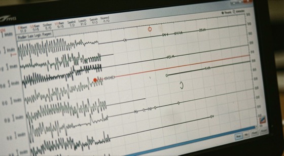 A logic analyzer screen filled with parallel digital traces, the cursor lines measuring the width of one symbol against a time scale